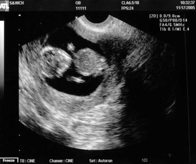 peanut-16