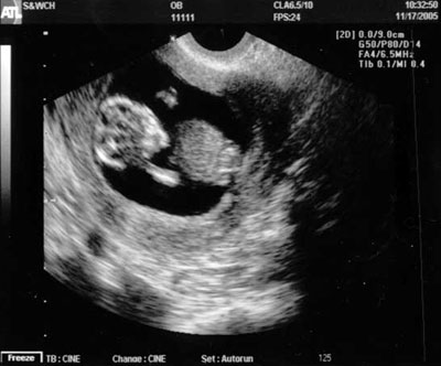 peanut-17
