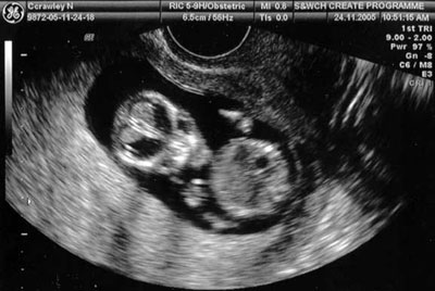 peanut-18