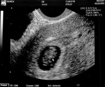 peanut-4
