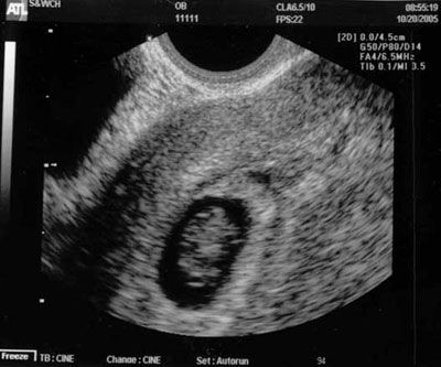 peanut-6