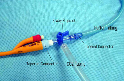 Turn On Power To Co 2 Device (green Button)