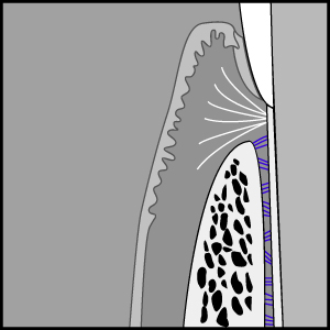 Gingival Fibres