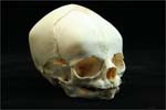 A Human Newborn Skull