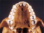 The Maxillary Teeth