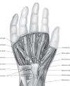 Dissected Hand